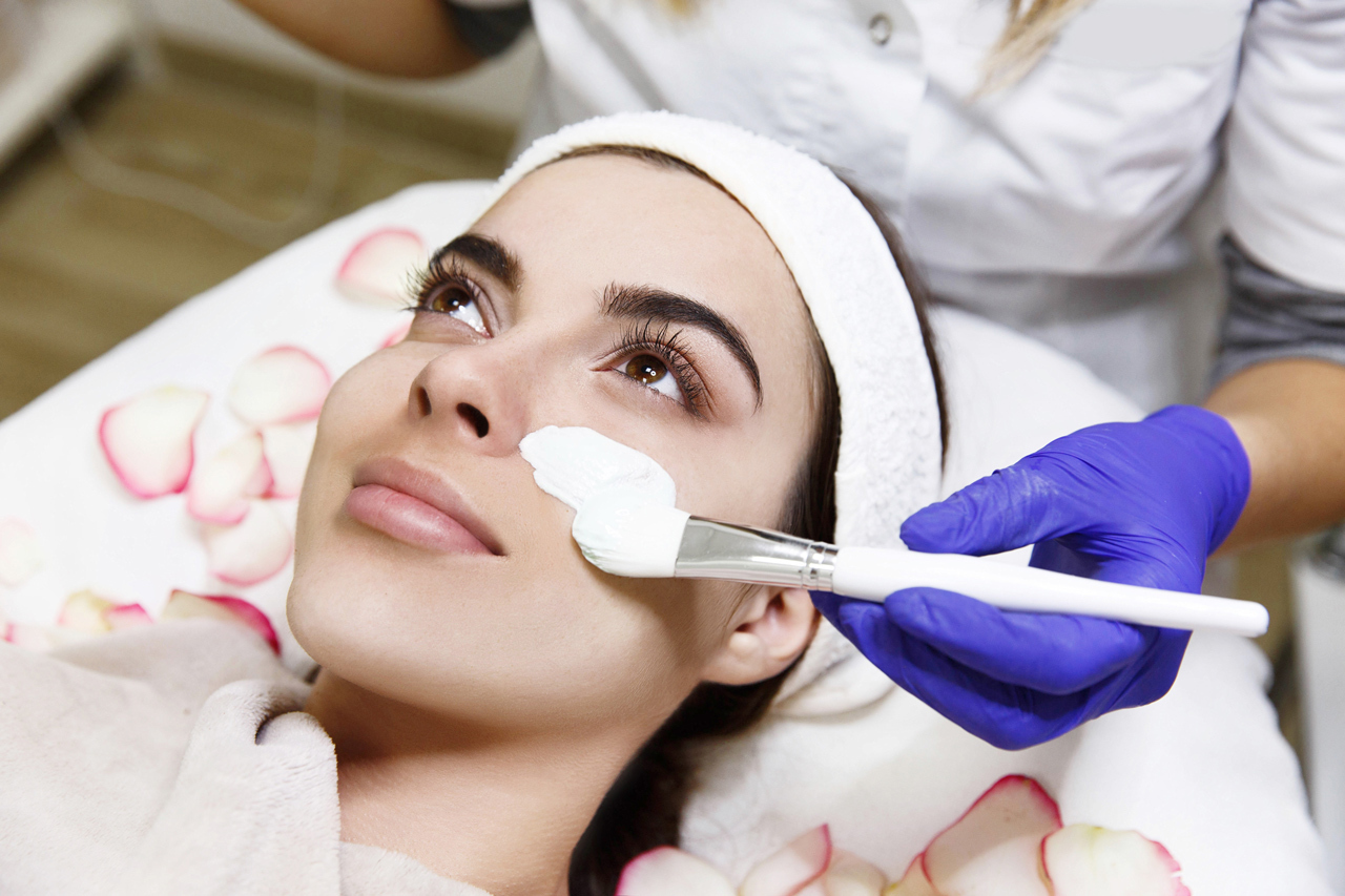 Chemical Peel L4 Info
