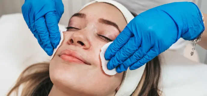 Chemical Peel L4 Image